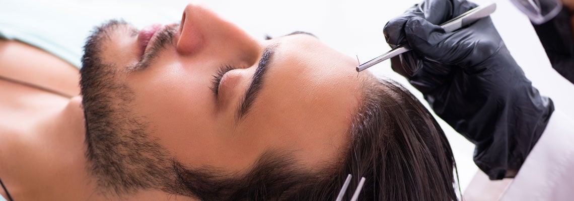 implantation des cheveux